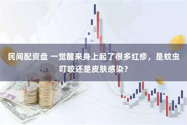 民间配资盘 一觉醒来身上起了很多红疹，是蚊虫叮咬还是皮肤感染？
